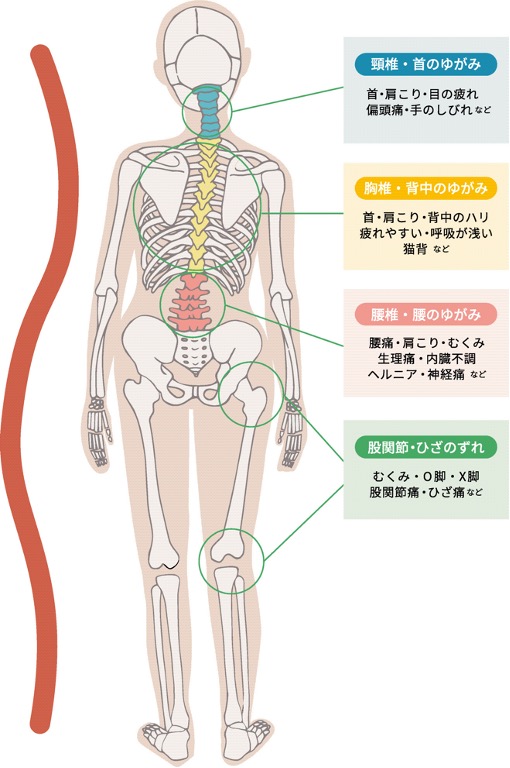 体の歪み