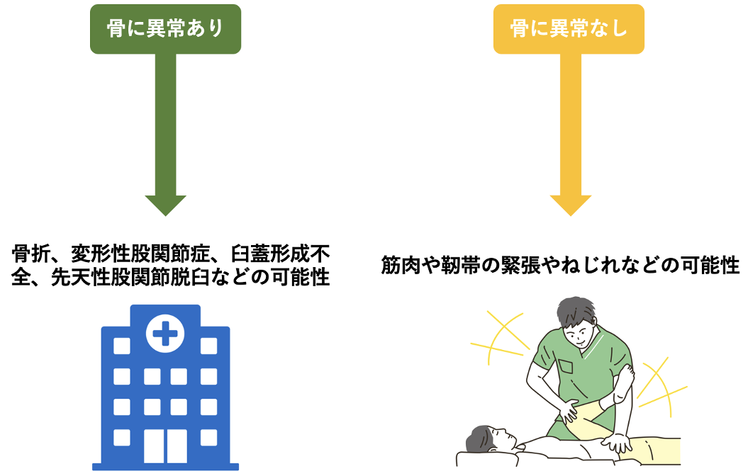 股関節の痛みの原因