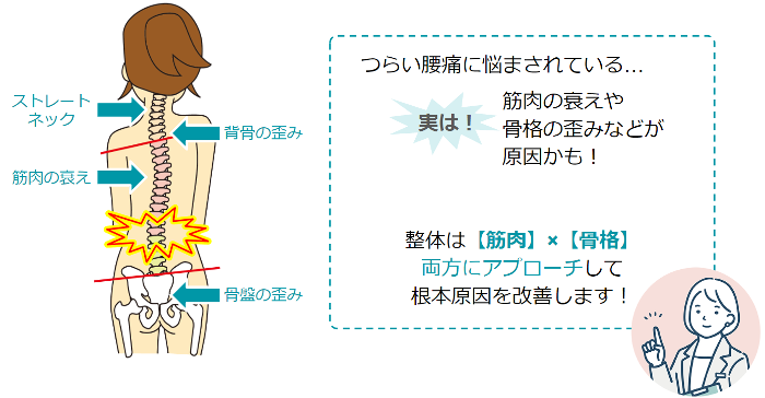 腰痛の原因