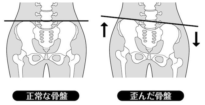 骨盤
