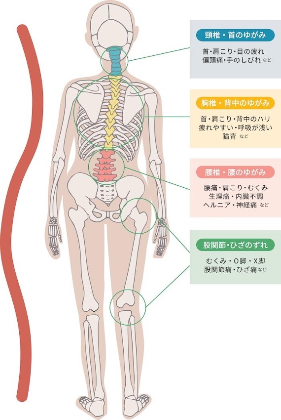 骨格の歪み