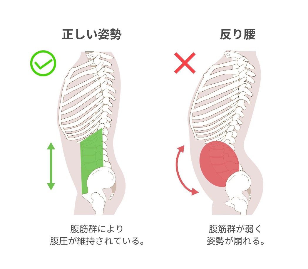 正しい姿勢と反り腰